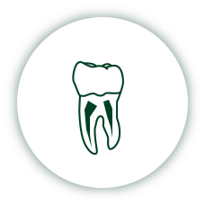 一般歯科根管治療